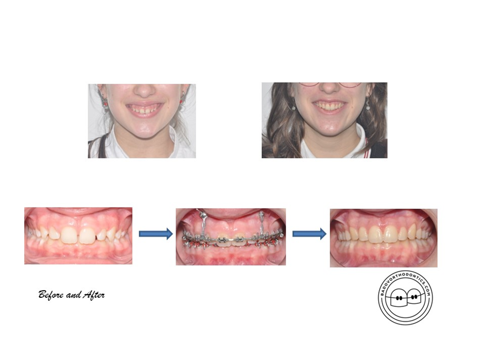 What is an orthodontist?
